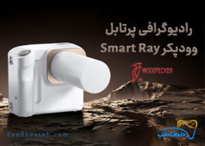 رادیوگرافی پرتابل وودپیکر Woodpecker مدل Smart Ray