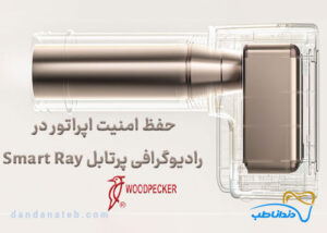 رادیوگرافی پرتابل وودپیکر Woodpecker مدل Smart Ray