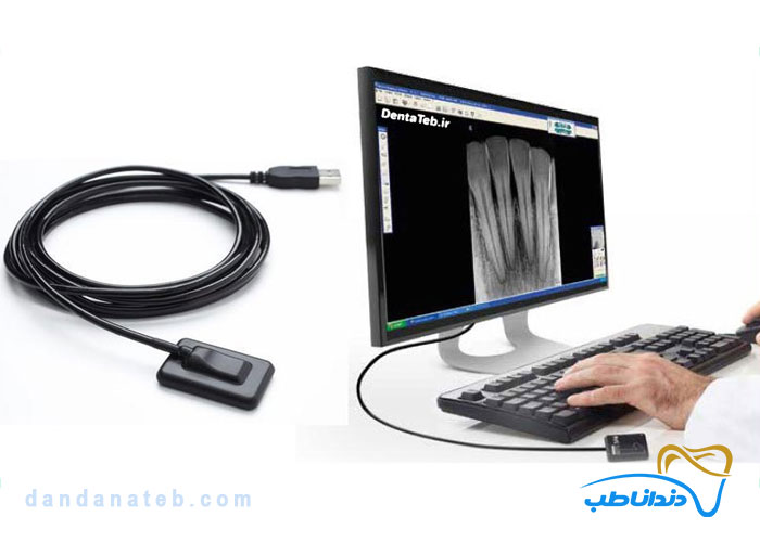 بهترین سنسور RVG دندانپزشکی در ایران