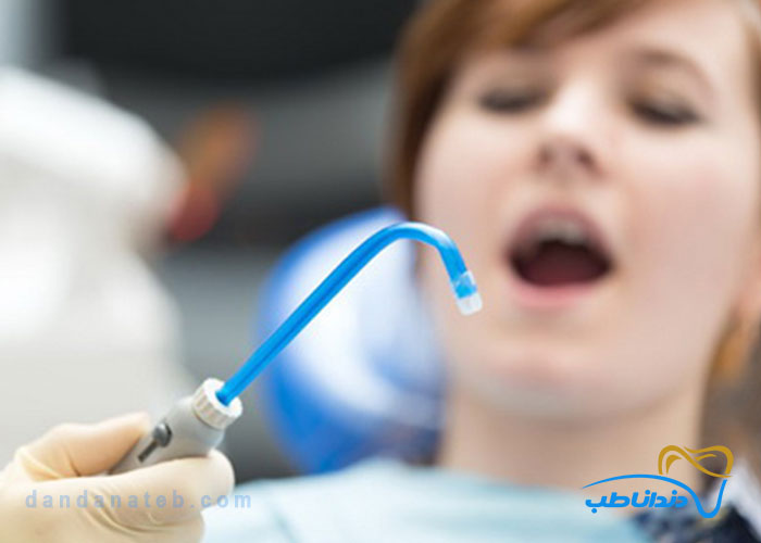 اهمیت استفاده از ساکشن برقی در دندانپزشکی
