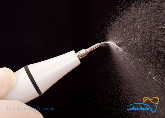 نحوه کار دستگاه جرم‌گیری دندان