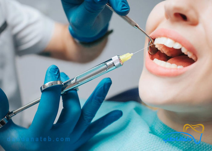آشنایی کامل با انواع سرنگ دندانپزشکی و اجزای آن