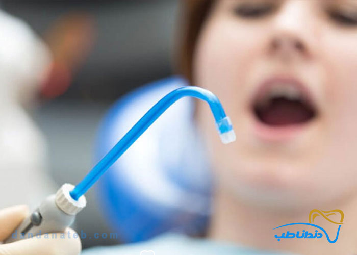 نحوه کار ساکشن دندانپزشکی