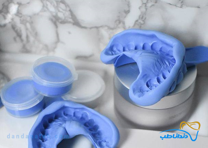 مقایسه مواد قالب گیری آلژیناتی با سیلیکونی