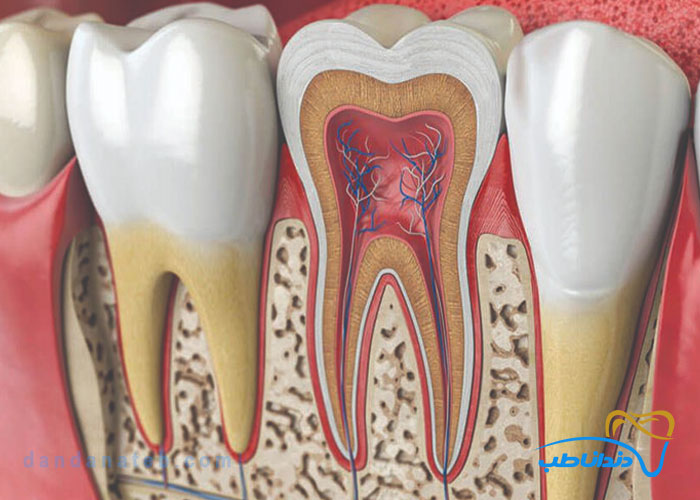 فرق کانال و ریشه دندان