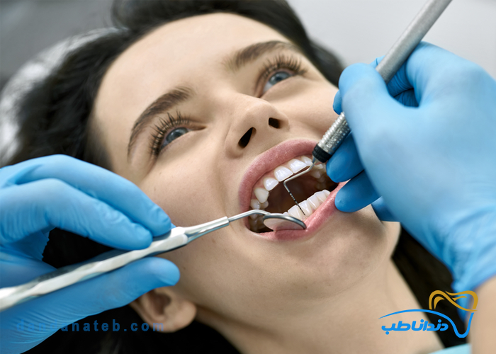 پروب دندانپزشکی چیست؟